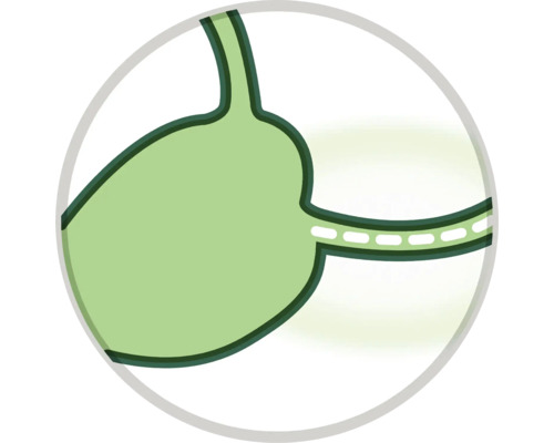 Symbole de réduction de l''estomac